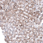 Immunohistochemical staining of human liver shows weak cytoplasmic positivity in hepatocytes.