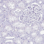 Anti-TNNT1 Antibody