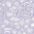 Immunohistochemical staining of human kidney shows no positivity as expected.