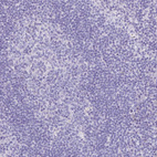 Anti-TNNT1 Antibody