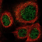 Immunofluorescent staining of human cell line A-431 shows localization to nucleoplasm & the Golgi apparatus.