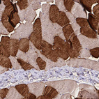 Anti-TNNT1 Antibody