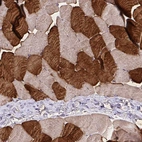 Immunohistochemical staining of human skeletal muscle shows strong cytoplasmic positivity in a subset of myocytes.