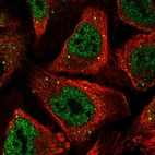 Anti-CSRNP1 Antibody