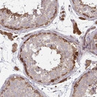 Anti-LMNTD2 Antibody
