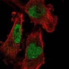 Anti-SETDB1 Antibody