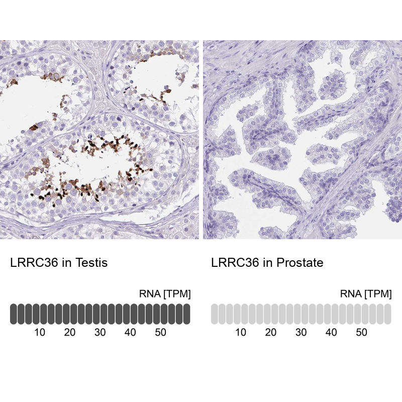 Anti-LRRC36 Antibody