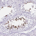 Anti-LRRC36 Antibody