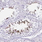 Immunohistochemical staining of human testis shows high expression.