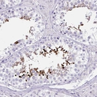 Immunohistochemical staining of human testis shows high expression.