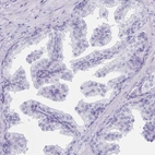 Immunohistochemical staining of human prostate shows low expression as expected.