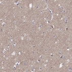 Anti-DMTN Antibody