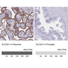 Anti-SLC2A1 Antibody