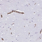 Immunohistochemical staining of human cerebral cortex shows strong membranous positivity in endothelial cells.