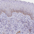 Immunohistochemical staining of human skin shows strong membranous positivity in squamous epithelial cells.