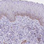 Anti-SLC2A1 Antibody