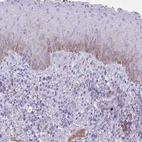 Immunohistochemical staining of human skin shows strong membranous positivity in squamous epithelial cells.