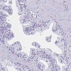 Immunohistochemical staining of human prostate shows no positivity in glandular cells as expected.