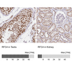 Anti-RFC4 Antibody