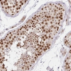 Immunohistochemical staining of human testis shows high expression.