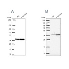 Anti-RFC4 Antibody