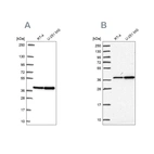 Western blot analysis using Anti-RFC4 antibody HPA058507 (A) shows similar pattern to independent antibody HPA049123 (B).