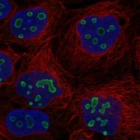Anti-TP53TG5 Antibody