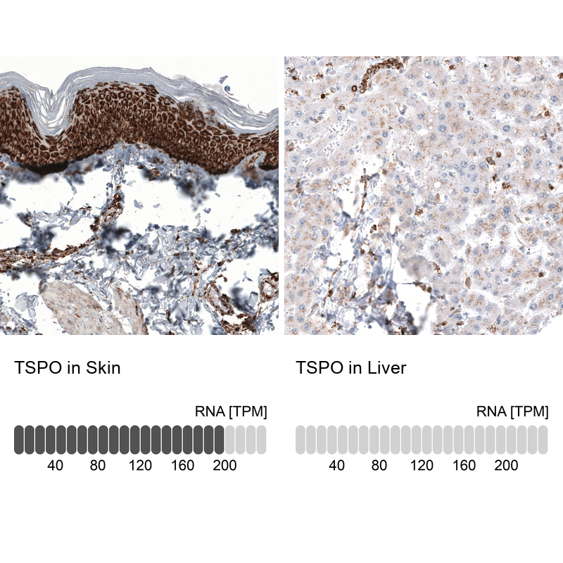 Anti-TSPO Antibody