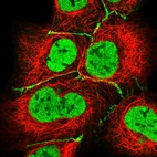 Anti-HLA-DPB1 Antibody