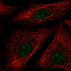 Anti-ID1 Antibody