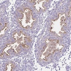 Anti-SEMA6B Antibody