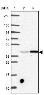 Anti-SLC39A3 Antibody
