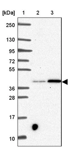 Lane 1: Marker [kDa] 250, 130, 95, 72, 55, 36, 28, 17, 10_br/_Lane 2: Human cell line RT-4_br/_Lane 3: Human cell line U-251 MG