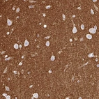 Immunohistochemical staining of human cerebral cortex shows strong positivity in neuropil.