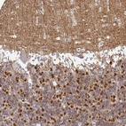 Immunohistochemical staining of human cerebellum shows strong cytoplasmic positivity in cells in granular layer.