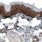 Immunohistochemical staining of human skin shows strong granular cytoplasmic positivity in squamous epithelial cells.
