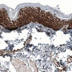 Immunohistochemical staining of human skin shows strong granular cytoplasmic positivity in squamous epithelial cells.