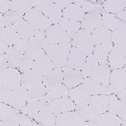 Immunohistochemical staining of human skeletal muscle shows no positivity in myocytes as expected.