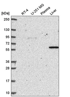 Western blot analysis in human cell line RT-4, human cell line U-251 MG, human plasma and human liver tissue.