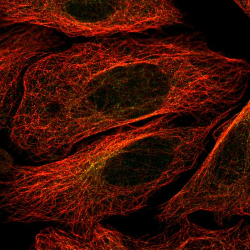 Anti-STK32B Antibody