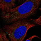 Anti-NEK4 Antibody
