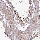 Immunohistochemical staining of human testis shows strong positivity in a subset of cells in seminiferous ducts.