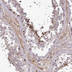 Immunohistochemical staining of human testis shows strong positivity in a subset of cells in seminiferous ducts.