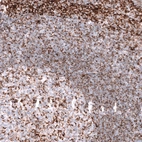 Immunohistochemical staining of human tonsil shows moderate to strong granular positivity in lymphoid cells.