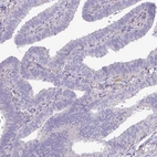 Immunohistochemical staining of human fallopian tube shows no positivity in glandular cells as expected.