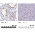 Anti-GPX4 Antibody