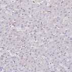 Immunohistochemical staining of human liver shows no positivity in hepatocytes as expected.