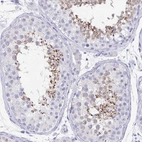 Immunohistochemical staining of human testis shows strong granular cytoplasmic positivity in subset of cells in seminiferous ducts.