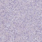 Immunohistochemical staining of human pancreas shows no positivity in exocrine glandular cells as expected.
