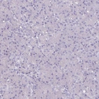 Immunohistochemical staining of human pancreas shows no positivity in exocrine glandular cells as expected.